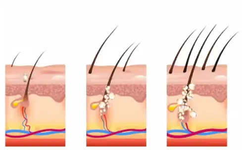 Rosemary Hair Growth Essence - Image 5