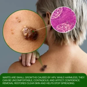 ClinixClear Wart Remover Patch