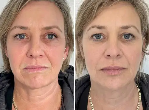 Crema Reafirmante Power Lift - ¡Último día de oferta - Image 7