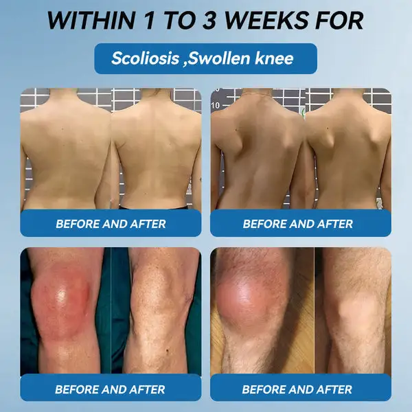 𝐁𝐏𝐂-𝟏𝟓𝟕 𝐉𝐨𝐢𝐧𝐭 𝐇𝐞𝐚𝐥𝐢𝐧𝐠 Capsules - Image 13