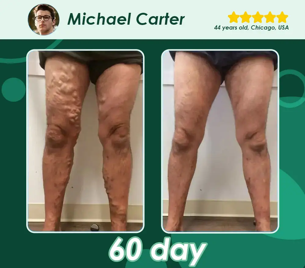 Ultra Concentrated Liquid Pearls Weight Management - Image 10