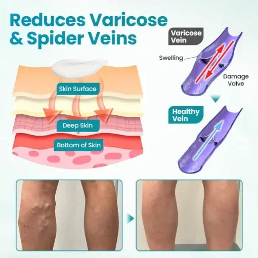 VeinAway Relief Cream - Image 2