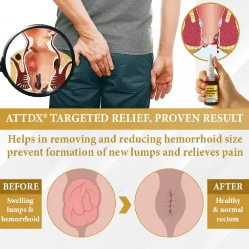 Apis Venom Hemorrhoid Cooling Spray - Image 5