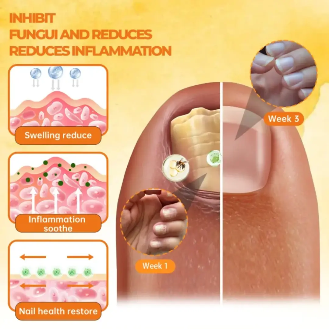 Bee Venom Nail Renewal Spray - Image 3