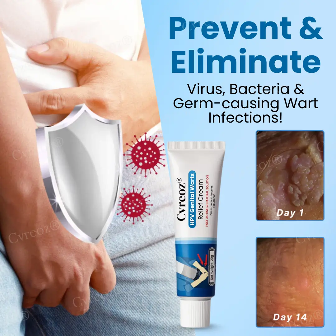 HPV Genital Warts Relief Cream - Image 2