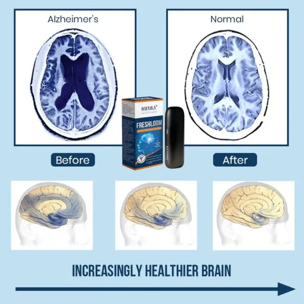FreshLoom Cognitive Regeneration Inhaler - Image 5