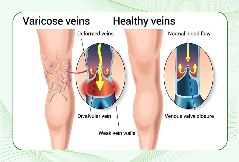 Detox Repair Supplement drops - Image 17