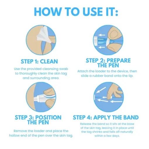 Skin Tag Removal Pen - Image 7