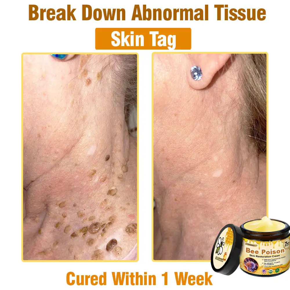 Bee Poison Skin Restoration Cream - Image 6