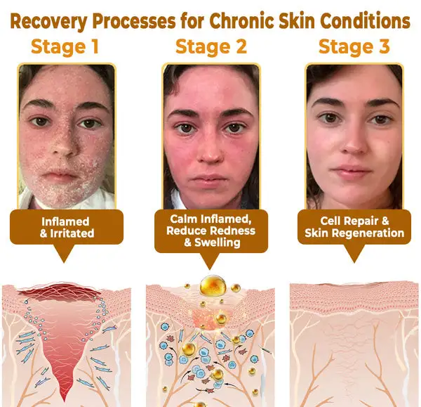 Bee Poison Skin Restoration Cream - Image 8