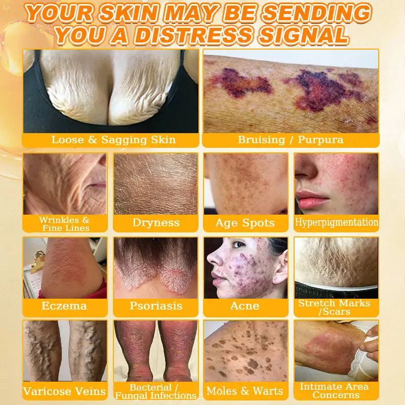 Bee Venom Skin Restoration Cream - Image 4