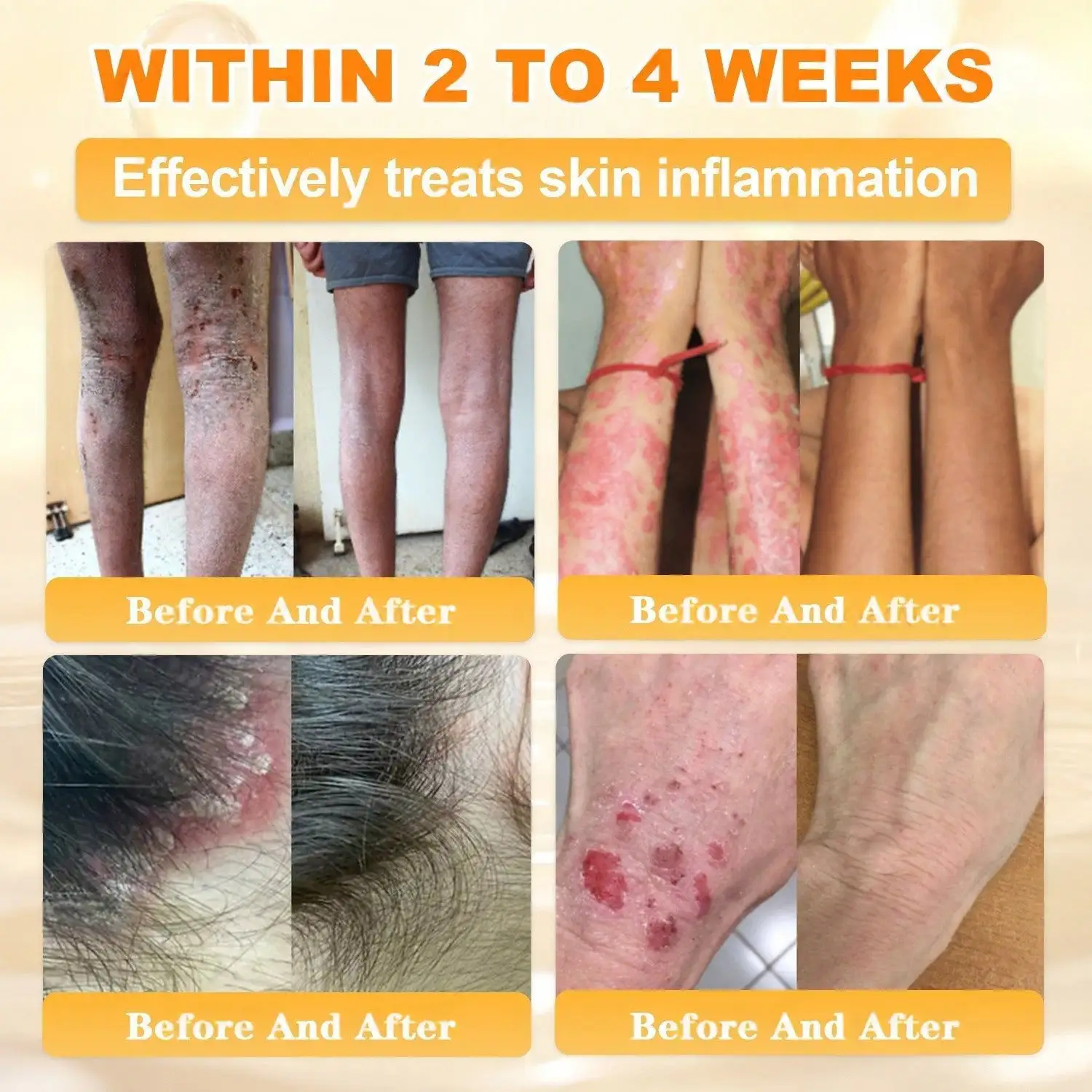 Bee Venom Skin Restoration Cream - Image 6