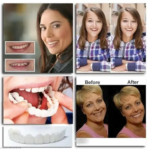 Adjustable Adhesive Dentures - Image 3