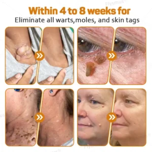 Alternative view of Tag Recede Bee Venom Treatment Cream