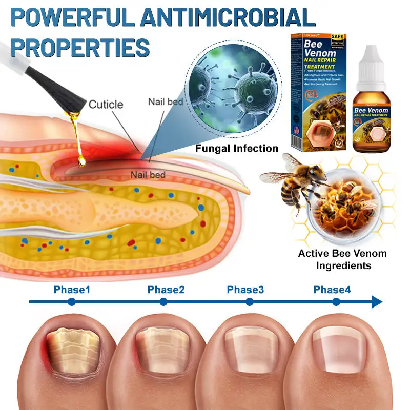 Bee Venom Nail Repair Treatment - Image 3