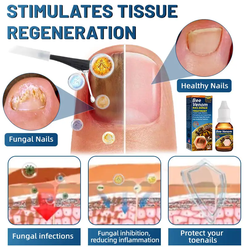 Bee Venom Nail Repair Treatment - Image 4
