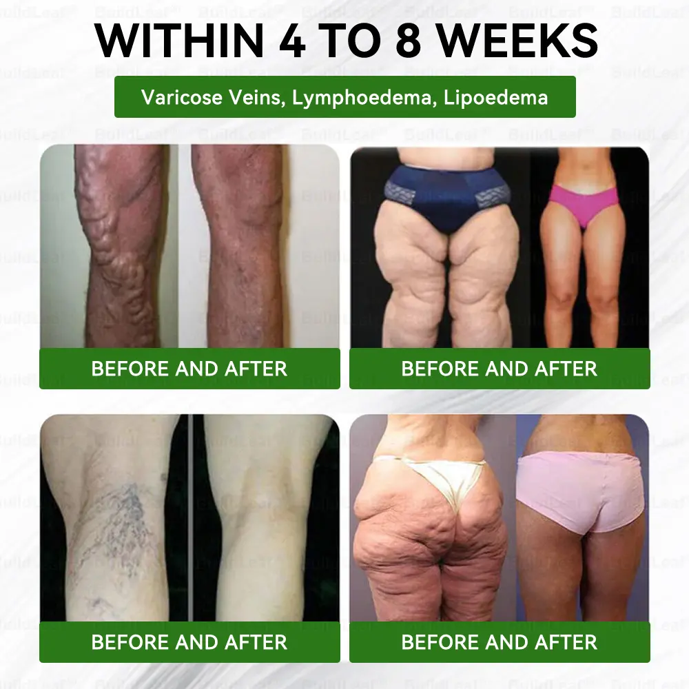 8-๐๐-1 ๐๐๐ฉ &b๐๐๐ฉ๐๐ก ๐ฎ๐๐บ๐
๐๐ค๐ก๐ช๐ฉ๐๐ค๐ฃย ๐ฐ๐ข๐ญ๐ก ๐๐จ๐ซ๐ข๐ง๐ ๐ ๐๐ฆ๐๐ ๐-๐ ๐๐จ๐ฅ๐ฅ๐๐ ๐๐ง ๐๐๐ฉ๐ญ๐ข๐๐๐ฌ ๐๐๐ &๐๐๐ - Image 8