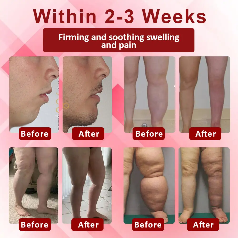 EdemaSupport Lymphatic Drainage Massage Cream - Image 2