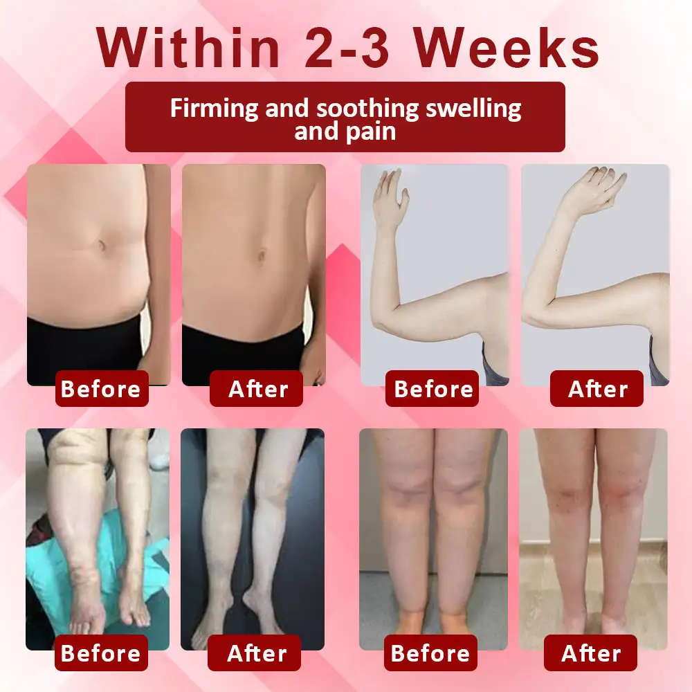 EdemaSupport Lymphatic Drainage Massage Cream - Image 3