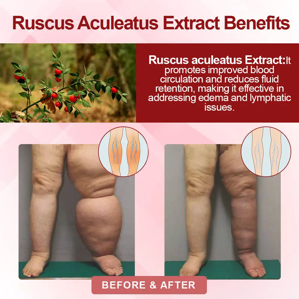 EdemaSupport Lymphatic Drainage Massage Cream - Image 8