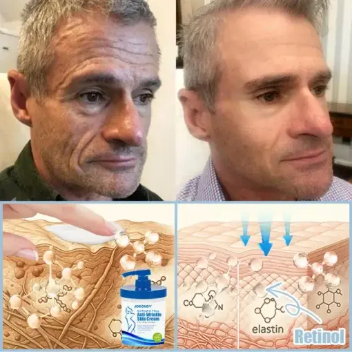 Anti-Wrinkle Skin Cream - Image 8