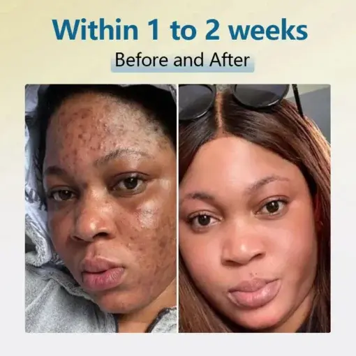 Bean Essence Serum - Image 4