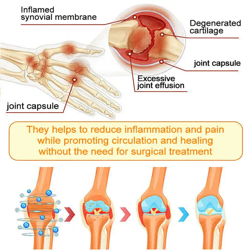 Bee Venom Pain-Relief Bone Healing Spray - Image 14