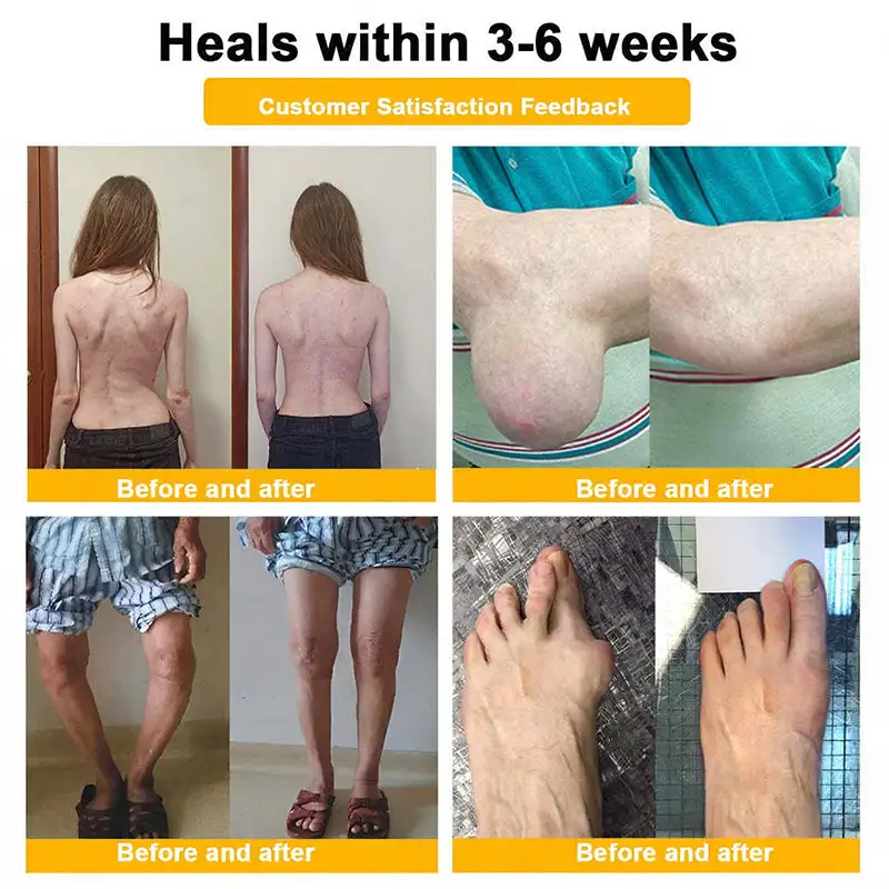 Bee Venom Pain-Relief Bone Healing Spray - Image 2