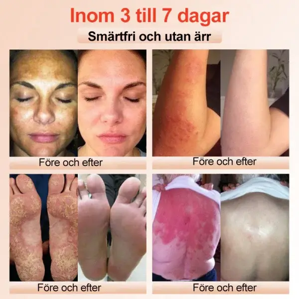 Purifying Peeling Gel - Image 3