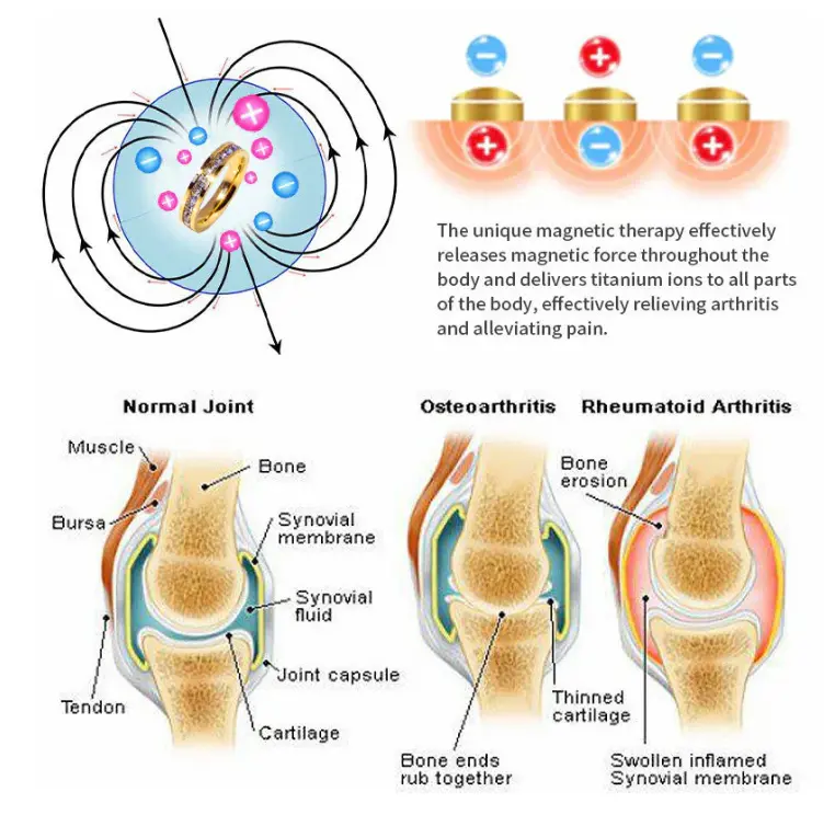 DIYSTAR Lymphatic Magnetic Therapy Diamond Ring - Image 5