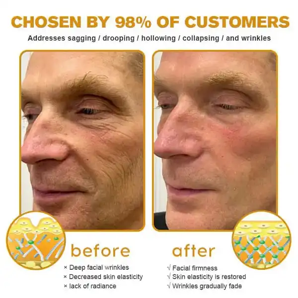 Bee Venom Awakening Peptide Eye Lifting Gel - Image 3