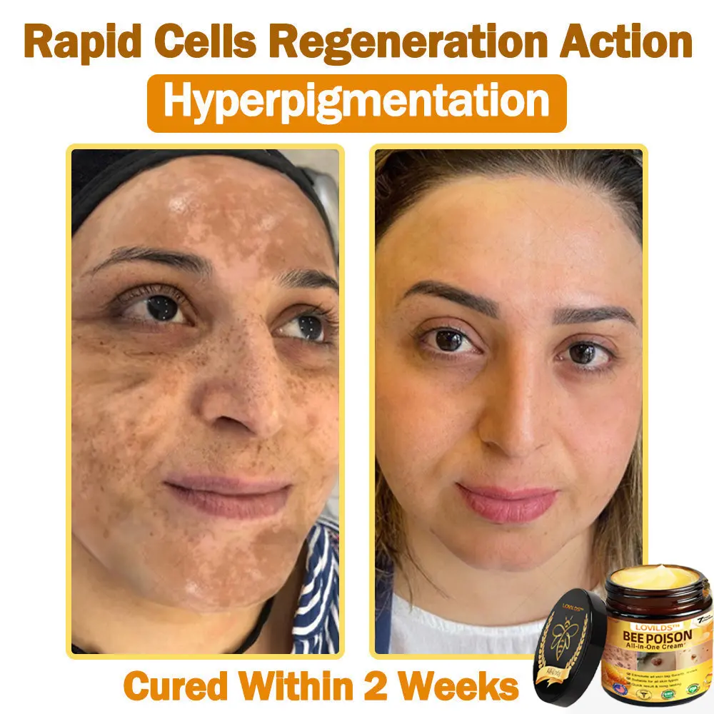 ๐๐๐ ๐๐๐ง๐จ๐ฆ ๐๐ฅ๐ฅ-๐ข๐ง-๐๐ง๐ ๐๐ซ๐๐๐ฆ - Image 8