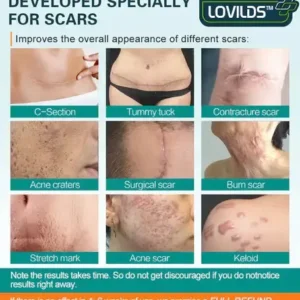 Alternative view of Advanced Scar Spray For All Types of Scars