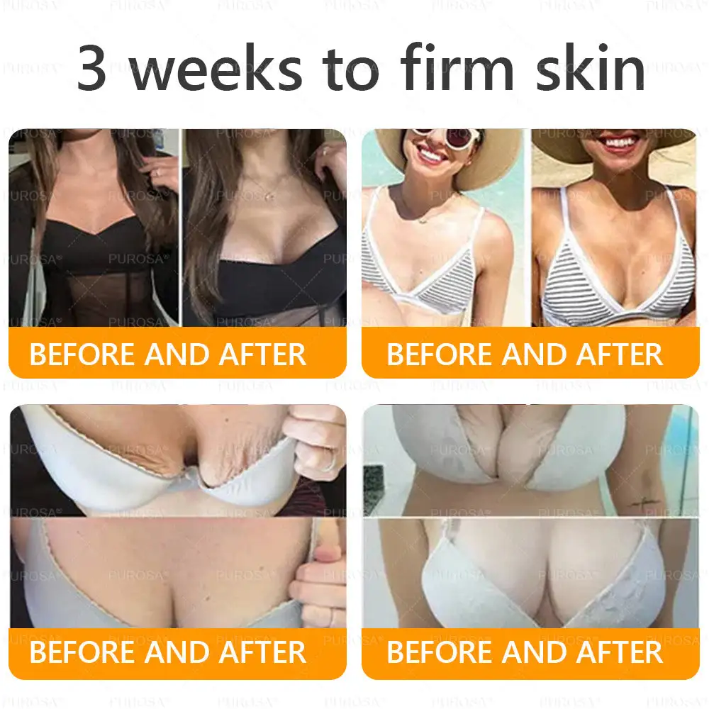 𝘽𝙀𝙀 𝙑𝙀𝙉𝙊𝙈 𝑺𝒌𝒊𝒏 𝑹𝒆𝒔𝒕𝒐𝒓𝒂𝒕𝒊𝒐𝒏 𝑪𝒓𝒆𝒂𝒎 - Image 6