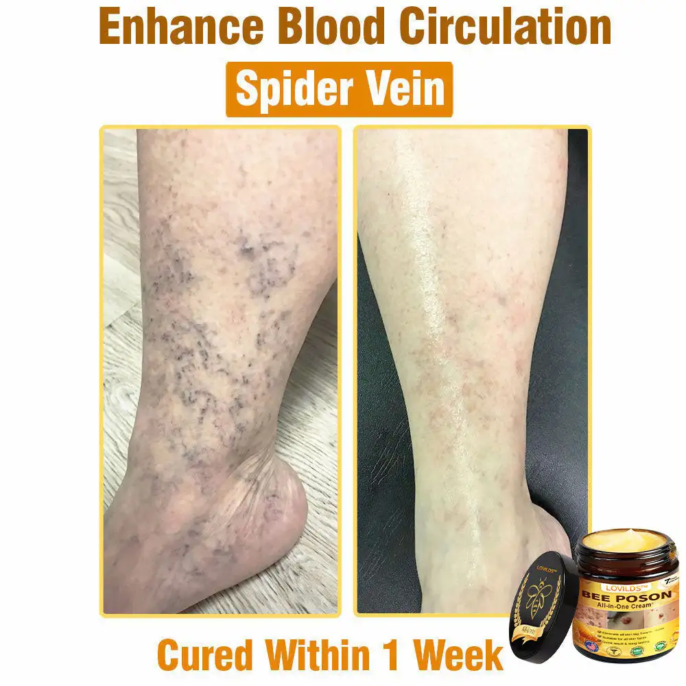 BEE POSON All-in-One Cream - Image 4