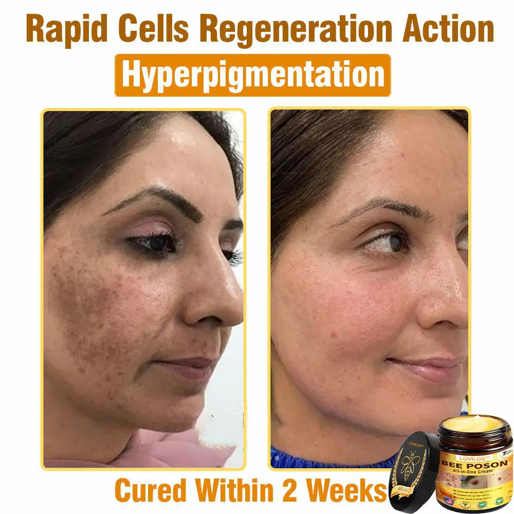 BEE POSON All-in-One Cream - Image 8