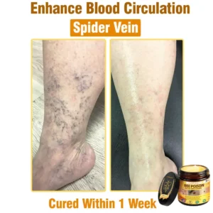 Alternative view of Bee Poison All-in-One Cream