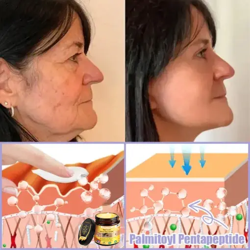 Bee Toxin Lift Cream - Image 9