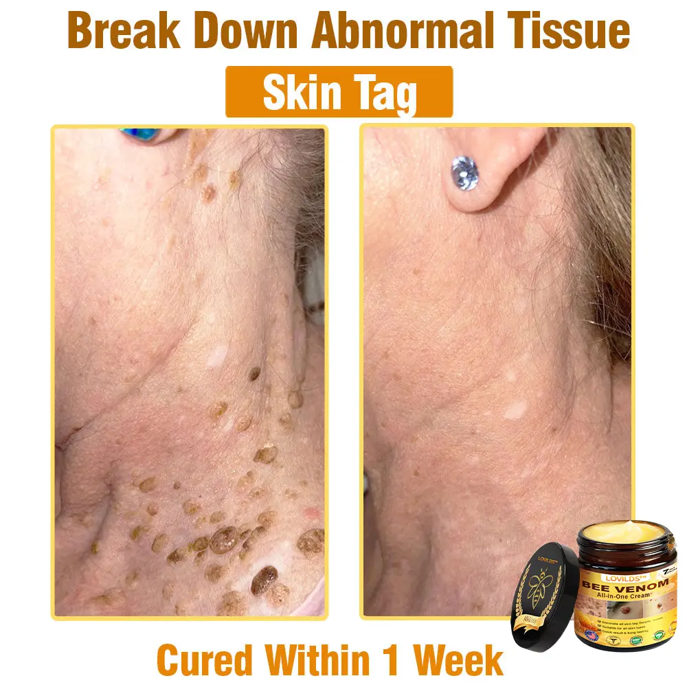 Bee Venom All-in-One Cream US Dermatologist Approved - Image 12