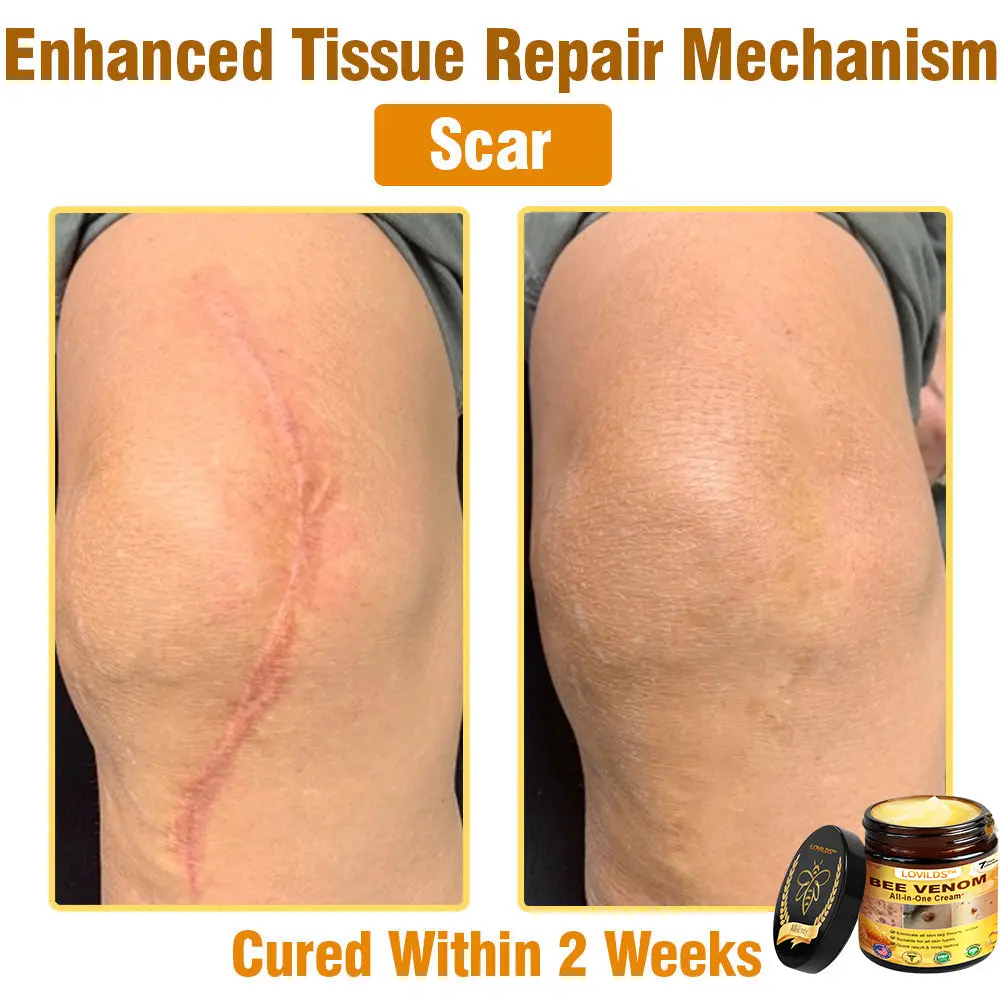 Bee Venom All-in-One Cream US Dermatologist Approved - Image 9