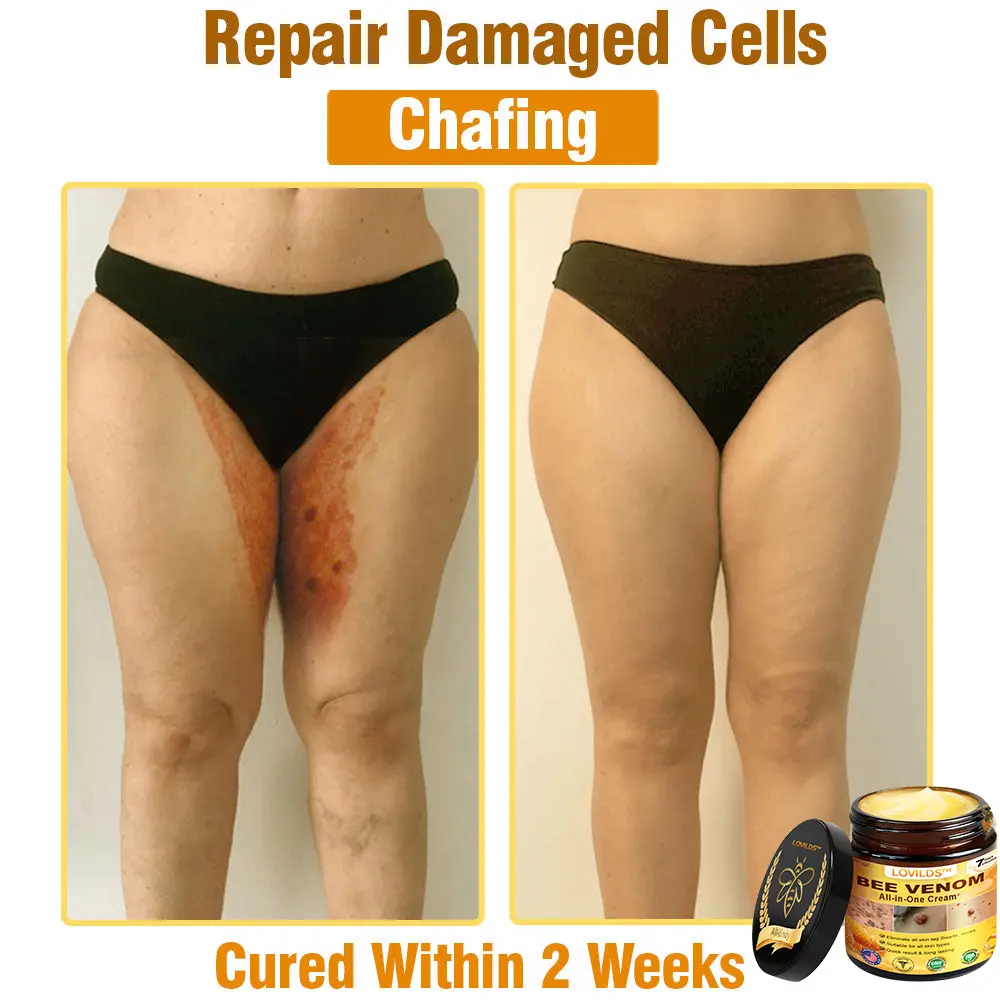 Bee Venom Cream – Anti-Aging Hydrating & Skin Repair - Image 13