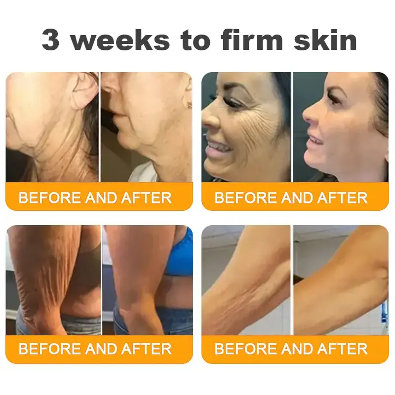 Bee Venom Cream – Anti-Aging Hydrating & Skin Repair - Image 6