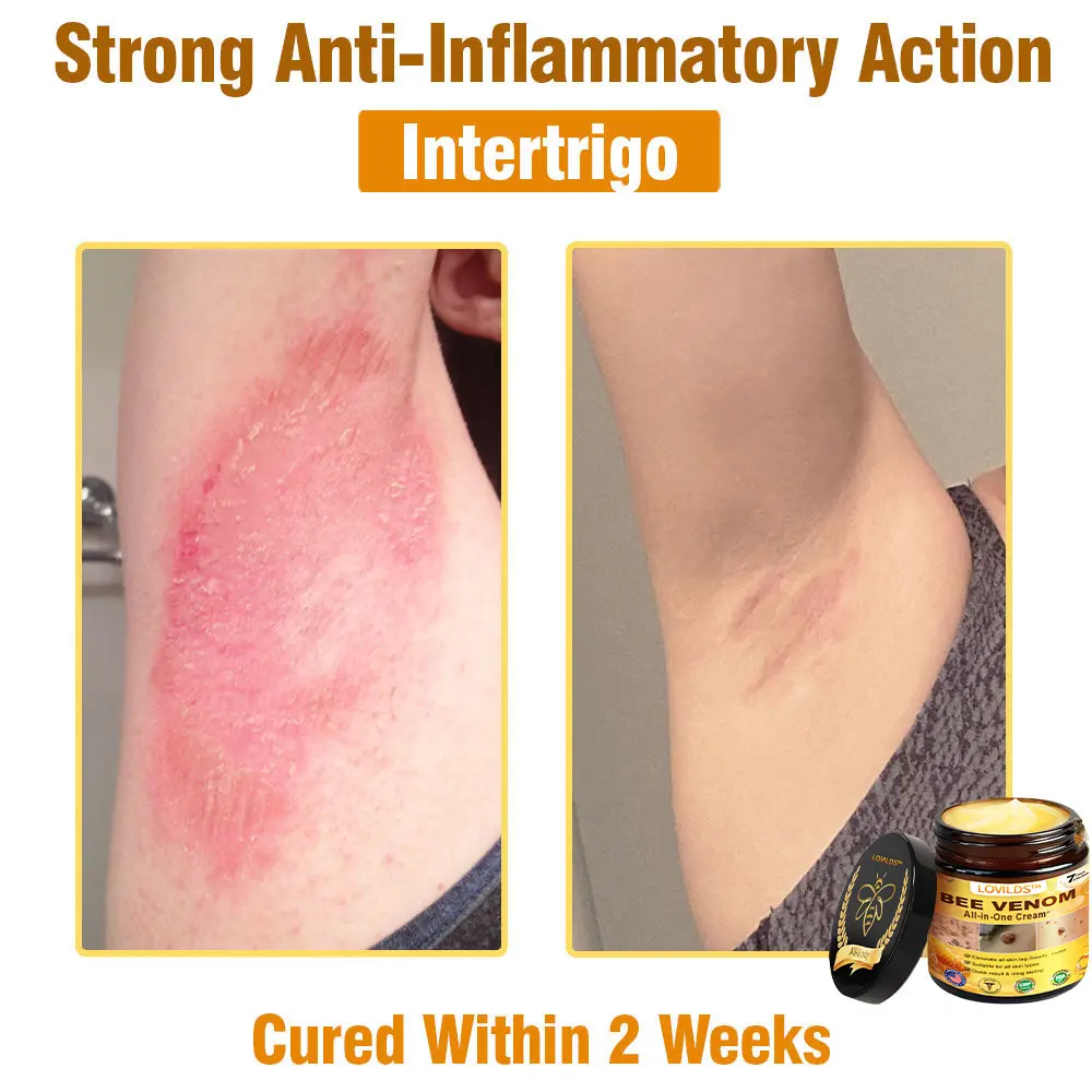 Bee Venom Cream - Image 10
