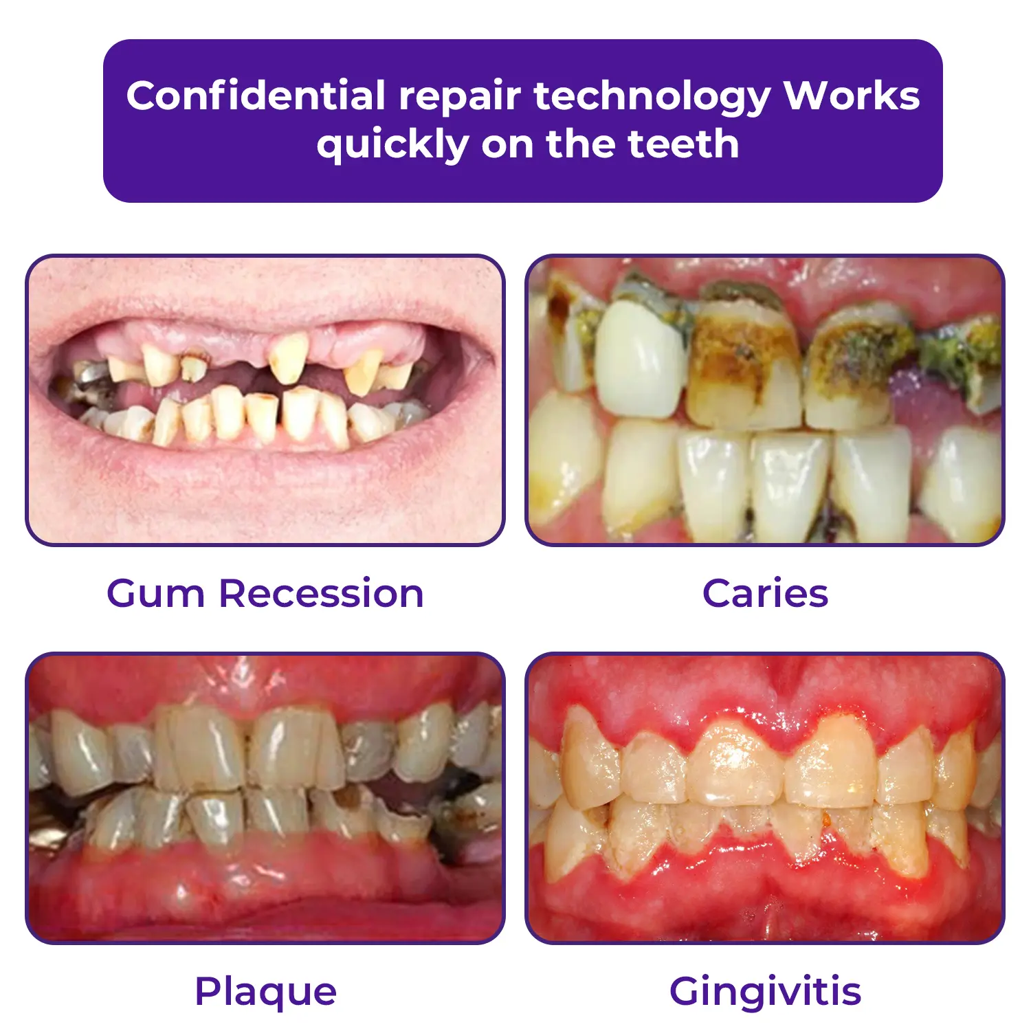 Dental Repair Mineral Powder - Image 3