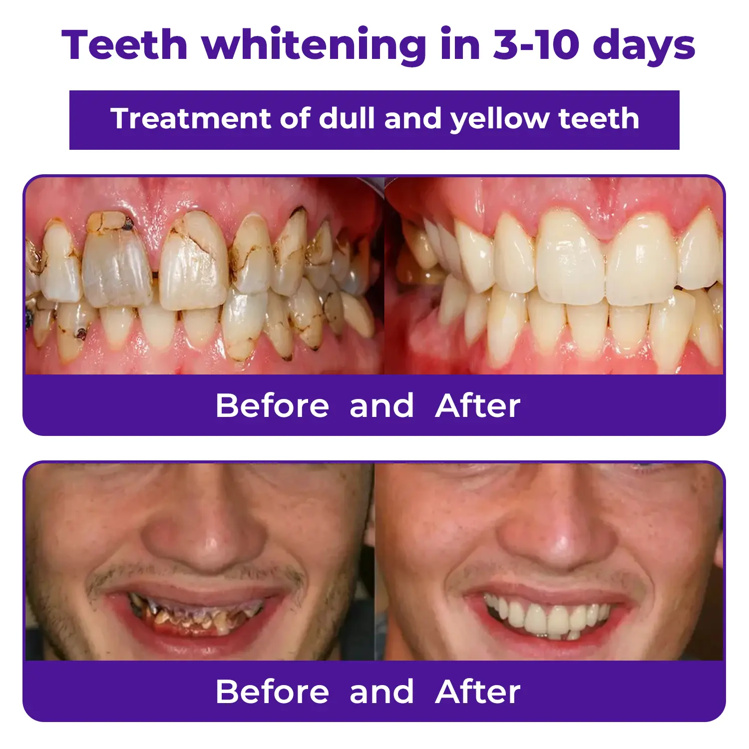 Dental Repair Mineral Powder - Image 4