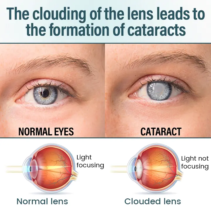 Eye Drops Serum - Image 3