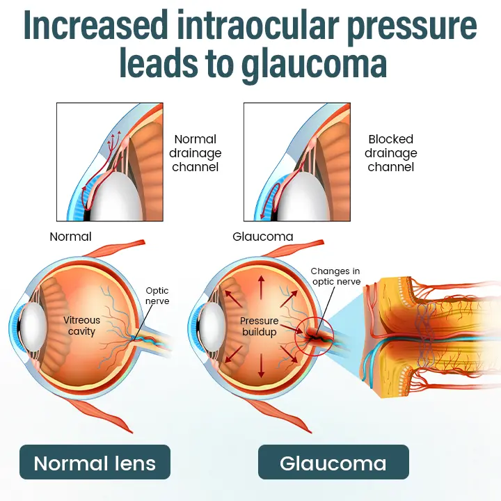 Eye Drops Serum - Image 4