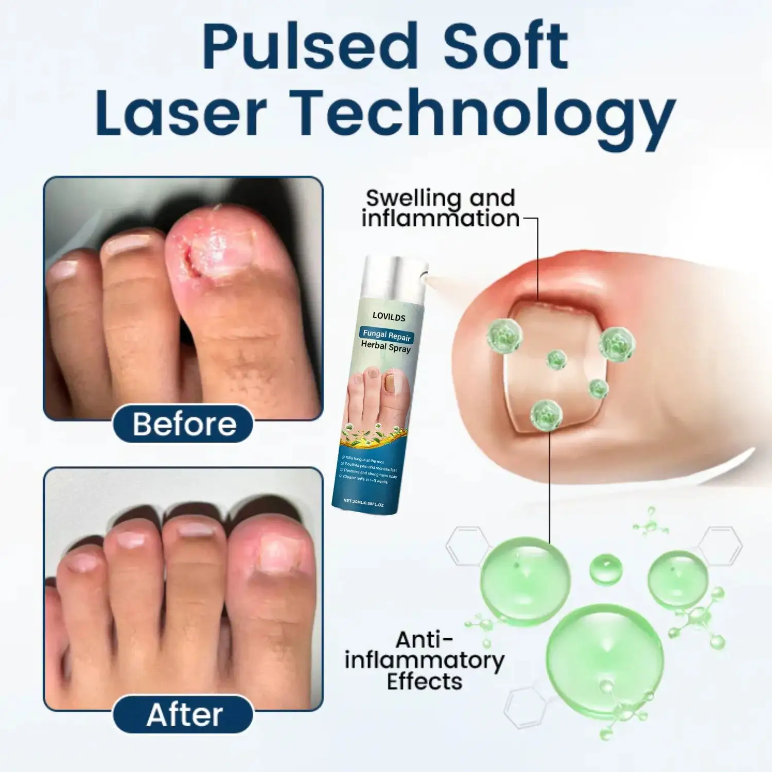 Fungal Repair Herbal Spray - Image 10