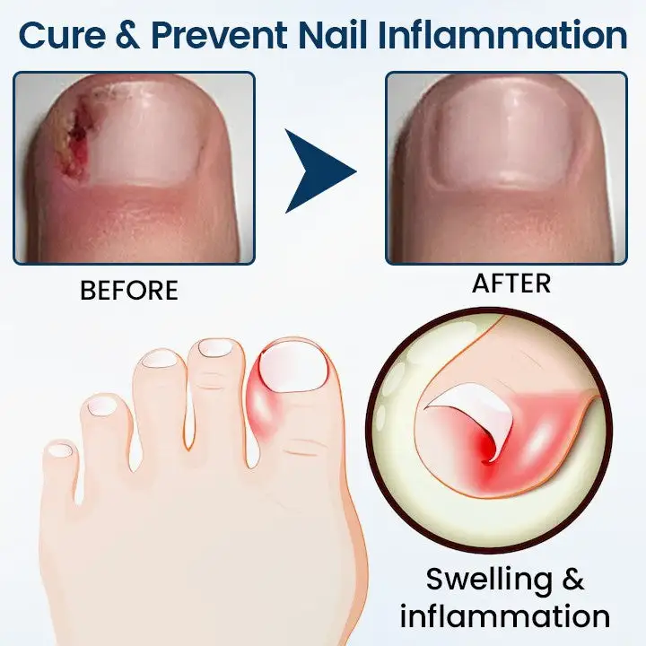 Fungal Repair Herbal Spray - Image 4