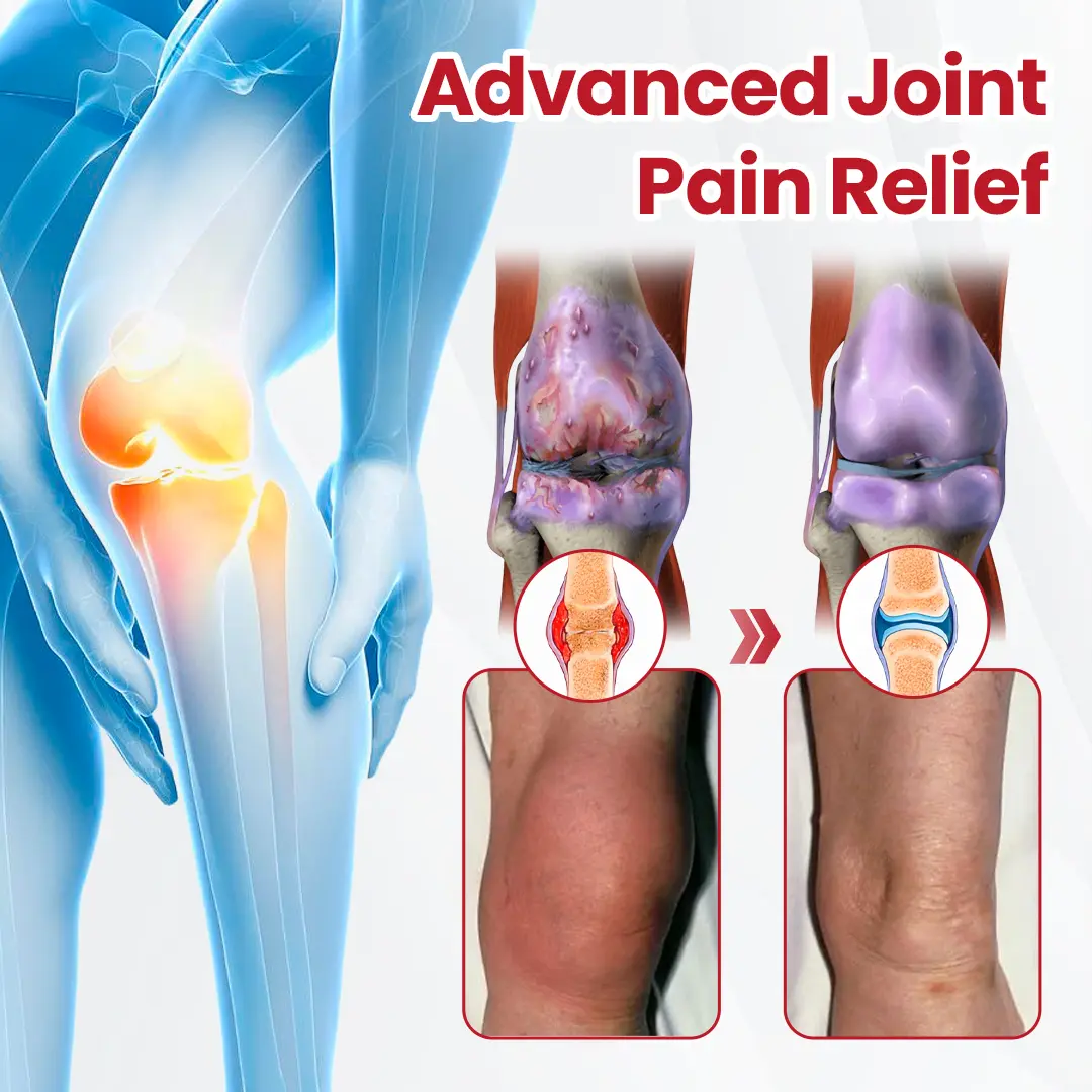 HorseEase Joint Relief Cream - Image 6